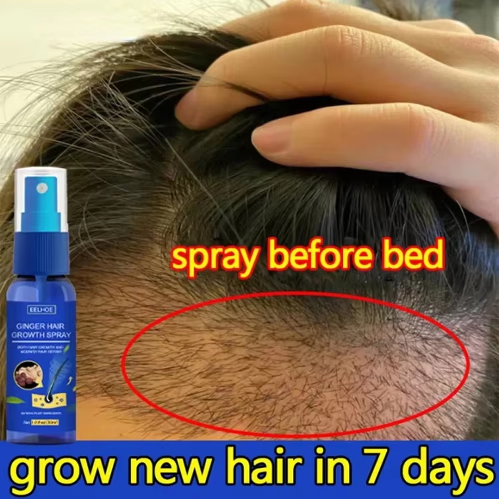 Ingrown Hair Serum - สเปรย์เร่งผมยาวขึ้นอย่างรวดเร็ว บำรุงรากผม ป้องกันผมร่วง เซรั่มปลูกผมใหม่ ซ่อมแซมหนังศีรษะที่เสียหาย บำรุงและดูแลเส้นผม