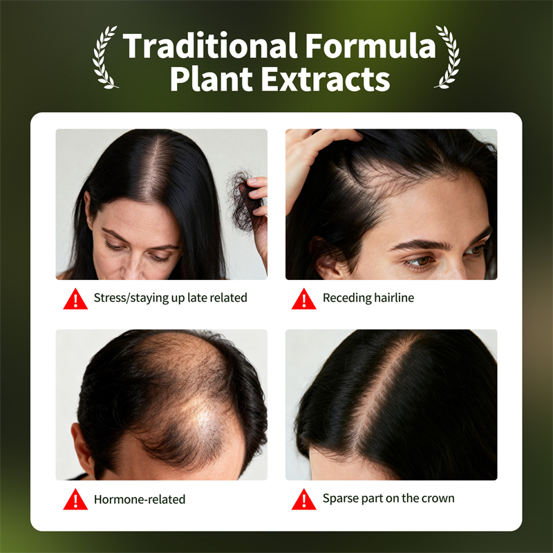 ชุดผลิตภัณฑ์บำรุงเส้นผมธรรมชาต - Ingrown Hair Serum บทวิจารณ์และราคา