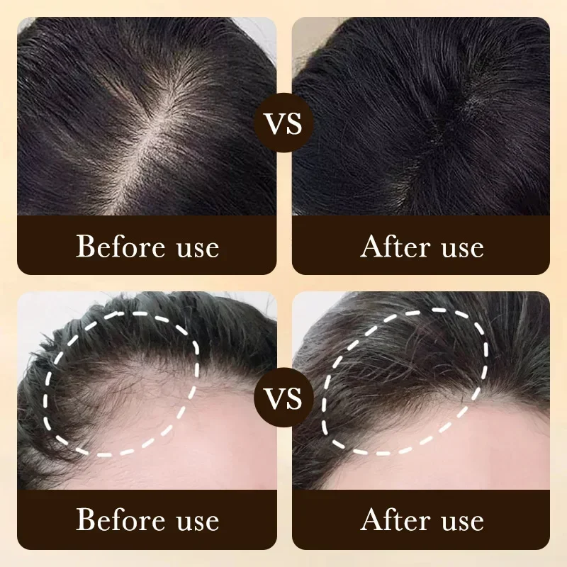 ผลิตภัณฑ์น้ำมันบำรุงผมไบโอติน  - Ingrown Hair Serum บทวิจารณ์และราคา