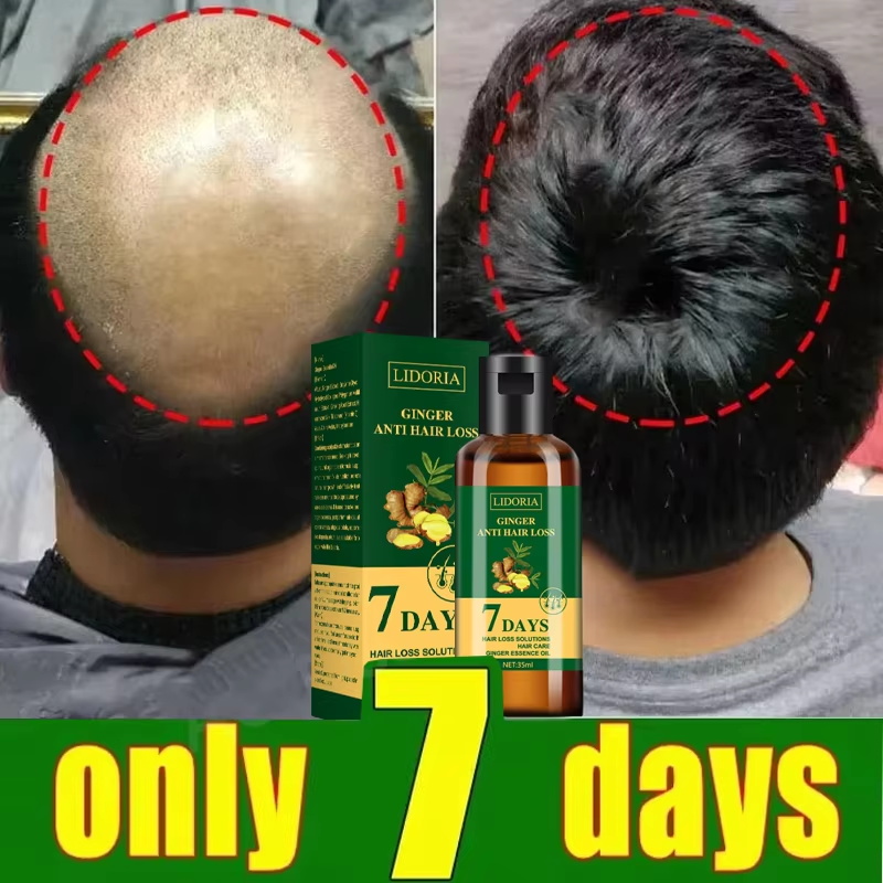 เซรั่มปลูกผม 7 วัน แคปซูลเร่งก - Ingrown Hair Serum บทวิจารณ์และราคา