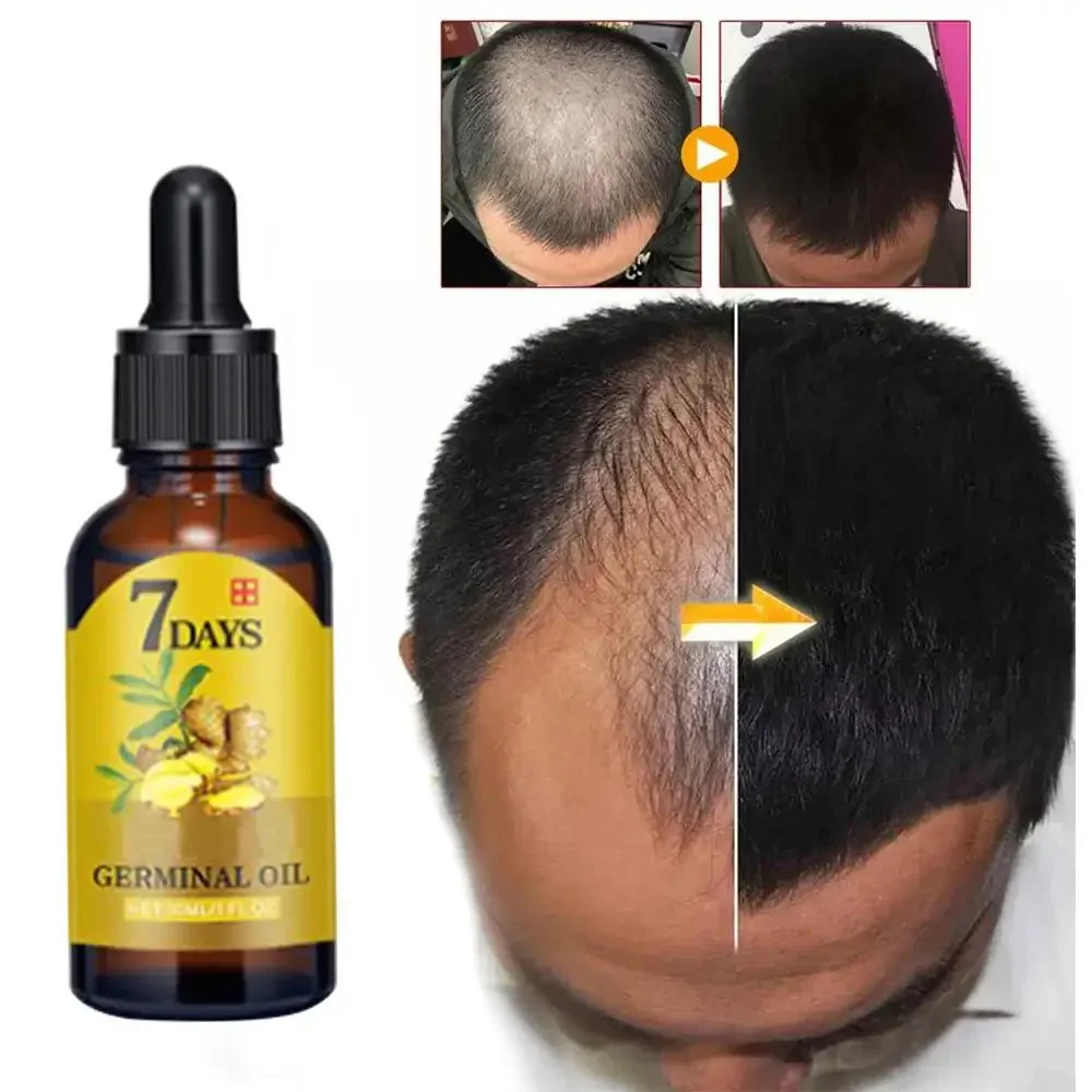 Hair Growth Ginger Fast Growin - Ingrown Hair Serum บทวิจารณ์และราคา